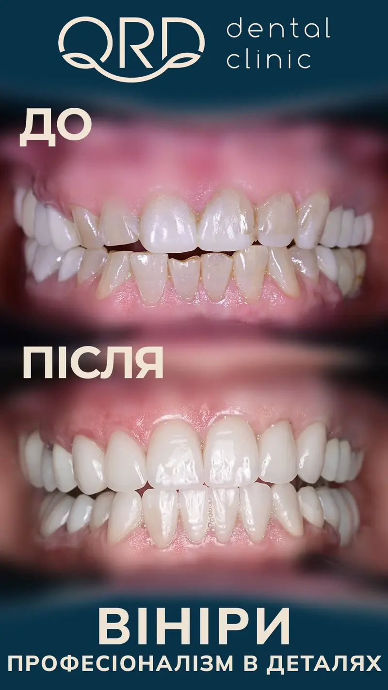 @qrd.dental 1